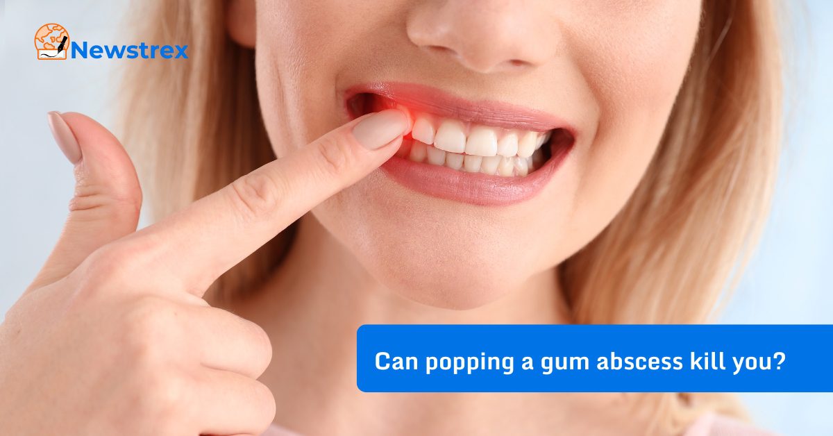Can popping a gum abscess kill you