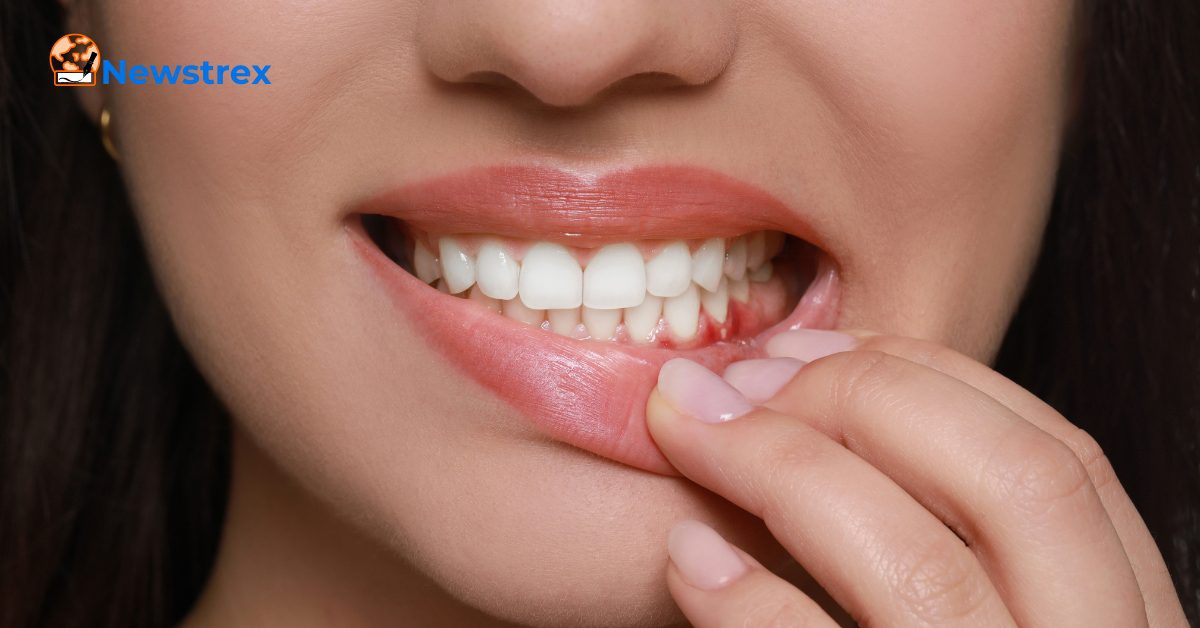 Can popping a gum abscess kill you?