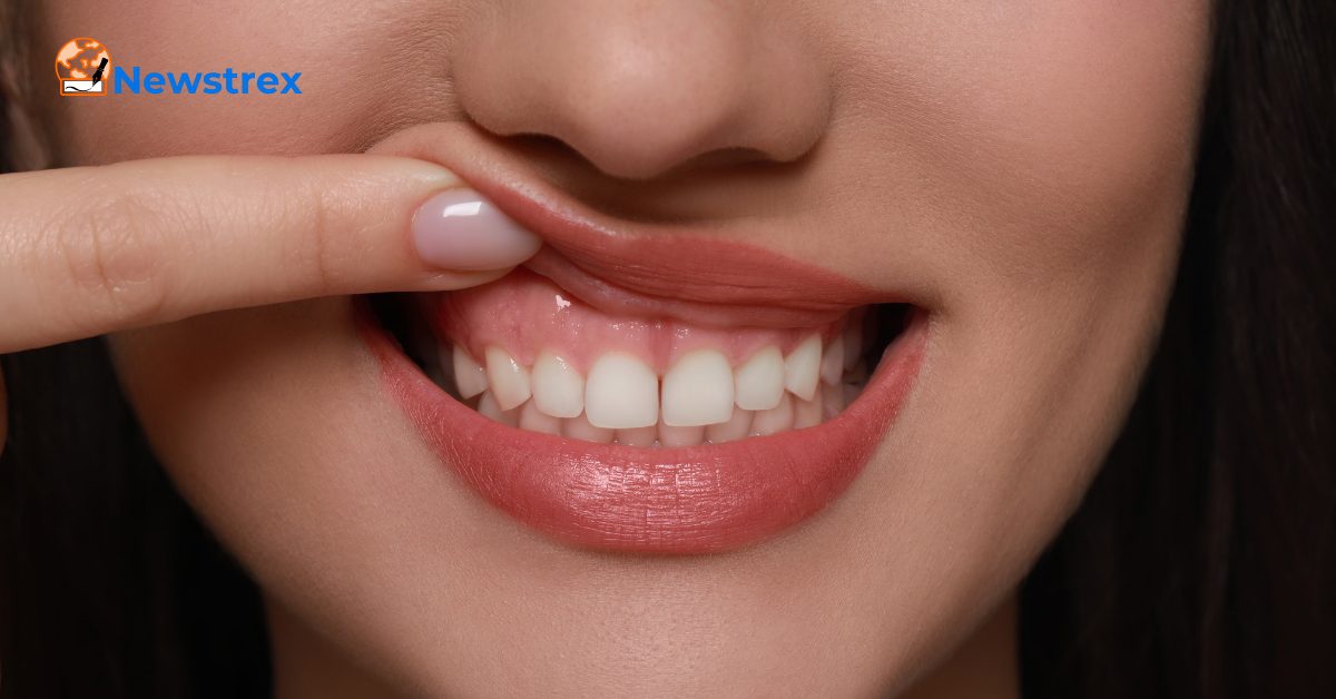 Can popping a gum abscess kill you?